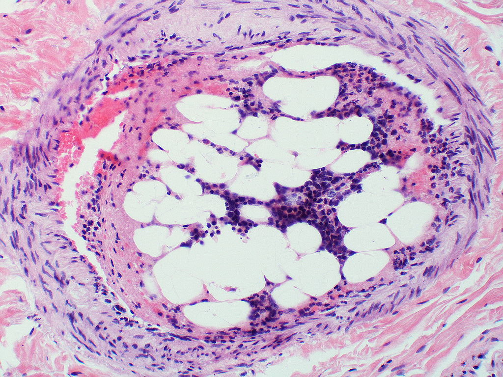 Bone marrow under a microscope