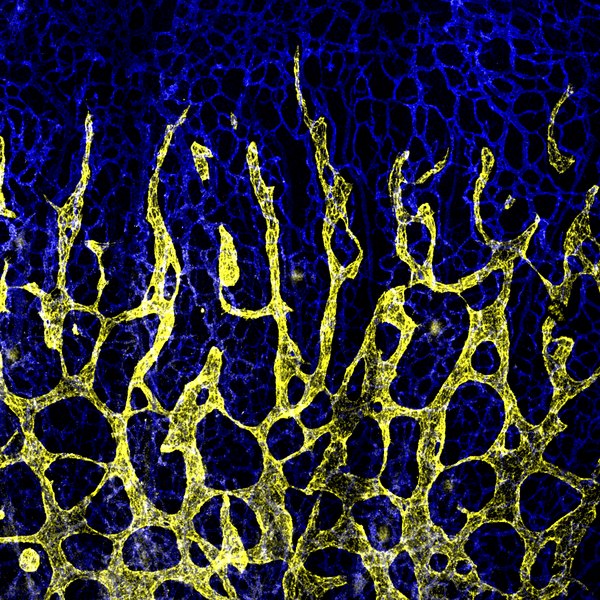 Developing lymphatic vessels in a mouse