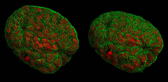 Super-resolution microscopy image of a nucleus preparing for cell division.