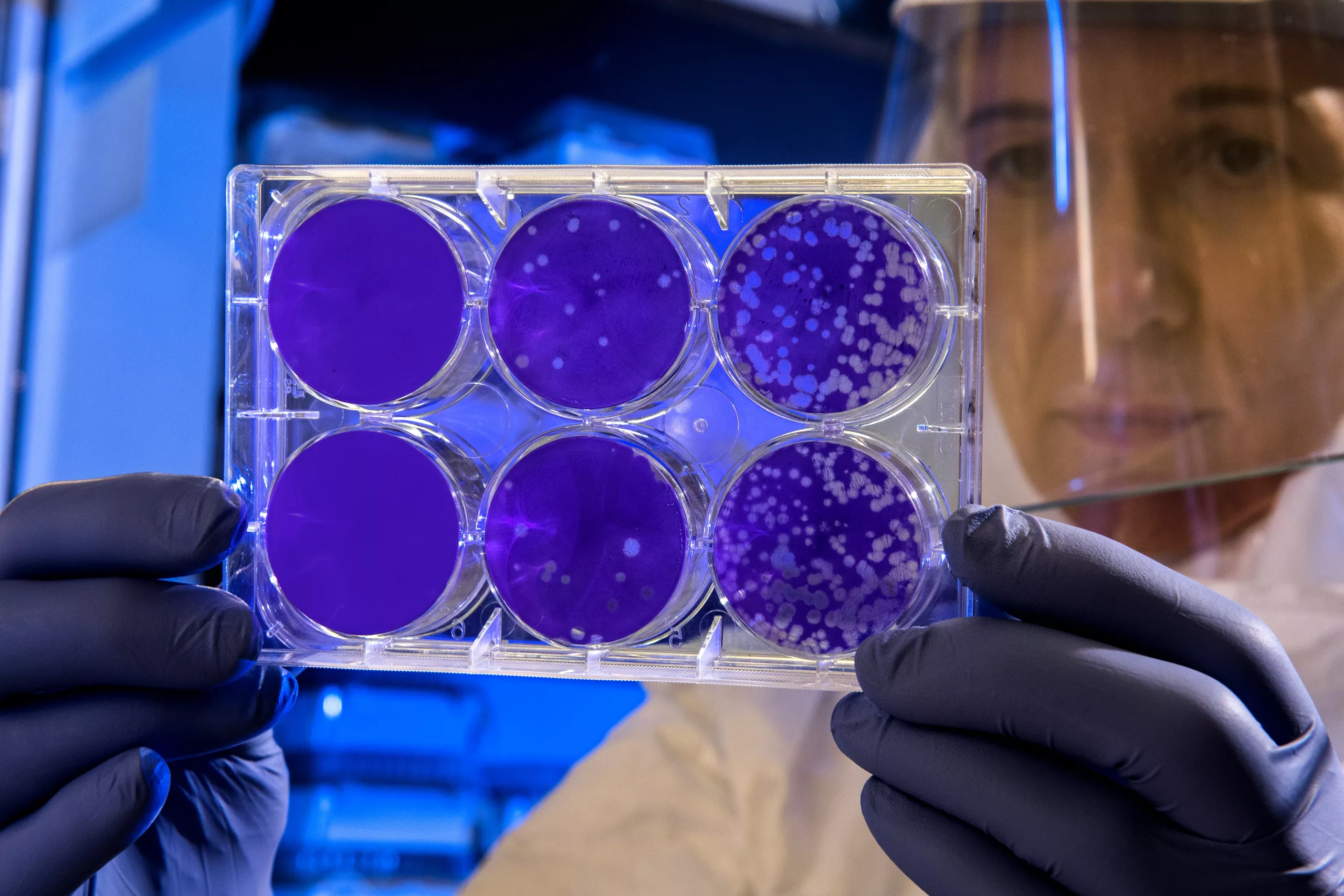 A scientist examines petri dishes used for studying microbes