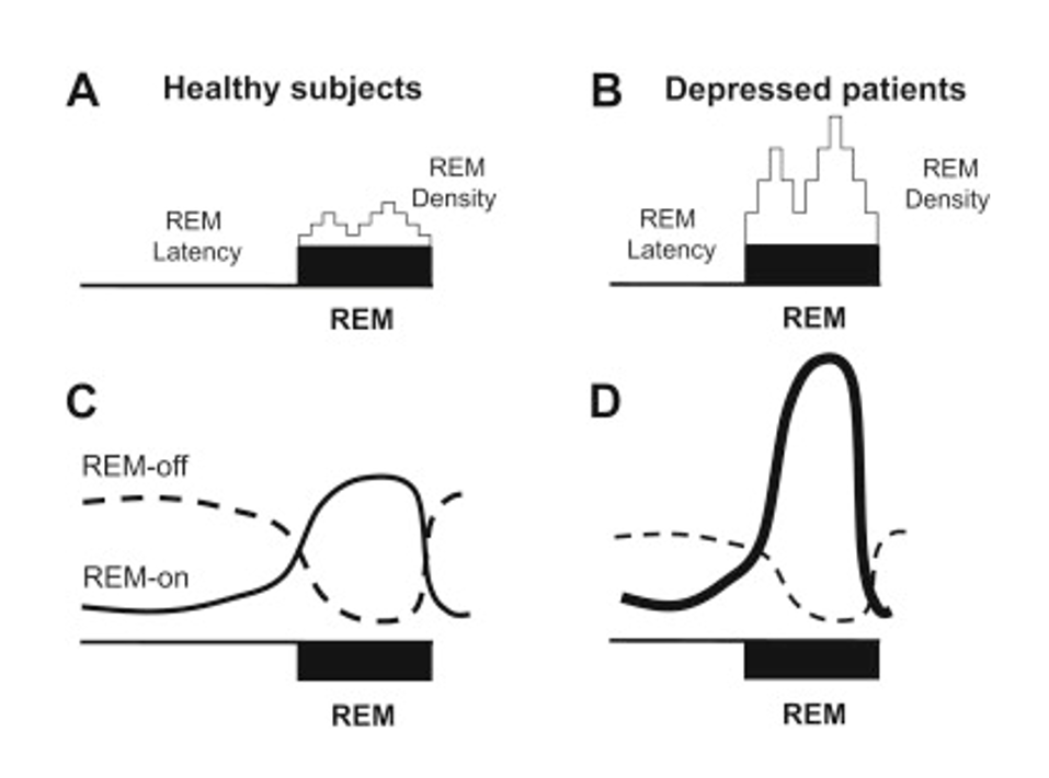 The troubled relationship between REM sleep and depression The Oxford