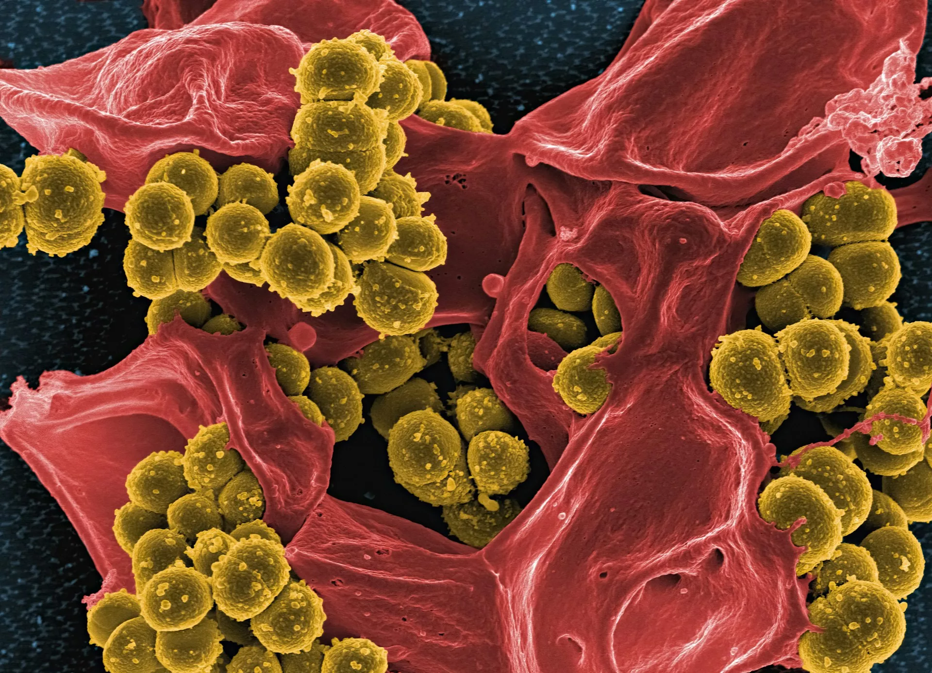 micrograph image of MRSA and a neutrophil